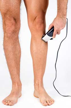 epilation laser homme paris 17